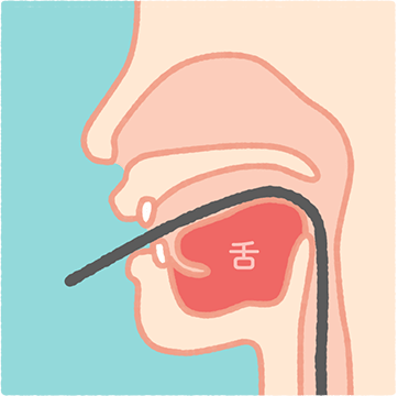 経口胃カメラ検査