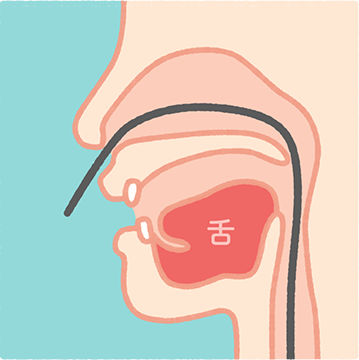 経鼻胃カメラ検査