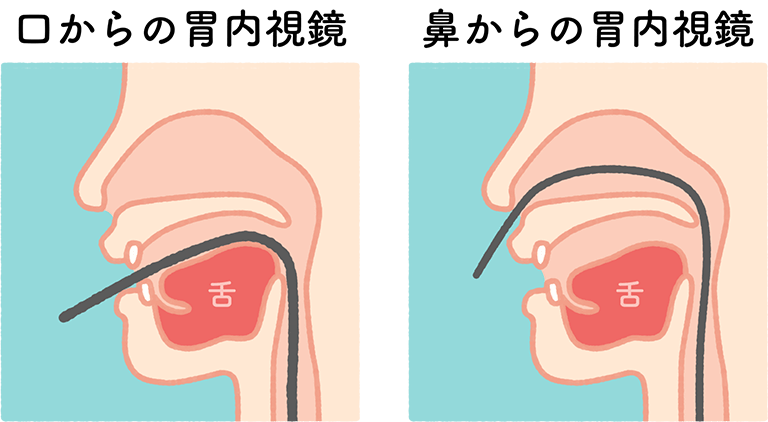 経口・経鼻内視鏡からお選びいただけます